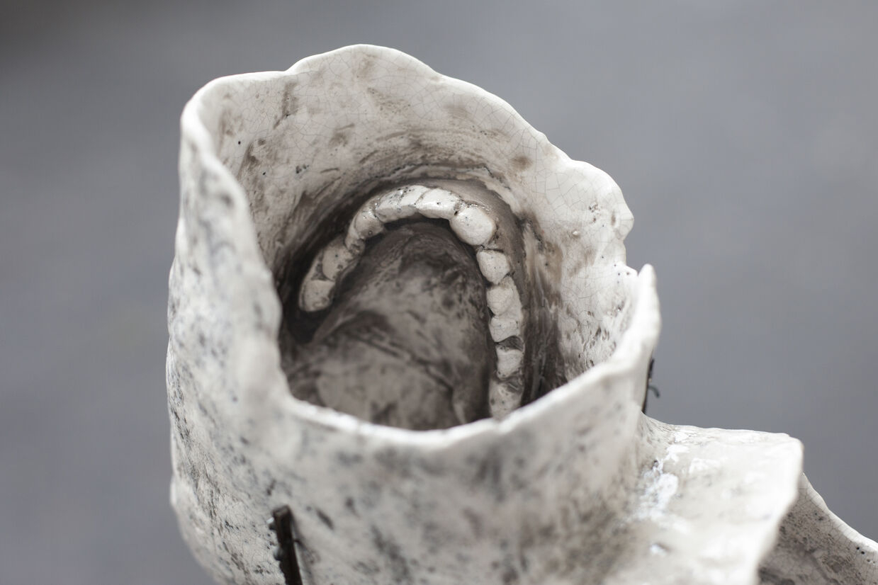 ceramic teeth
